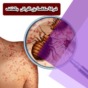 شركة مكافحة بق الفراش بالطائف شركة مكافحة حشرات شركة مكافحة صراصير بالطائف